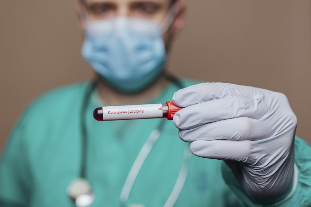 surgeon holding blood sample during coronavirus pandemic